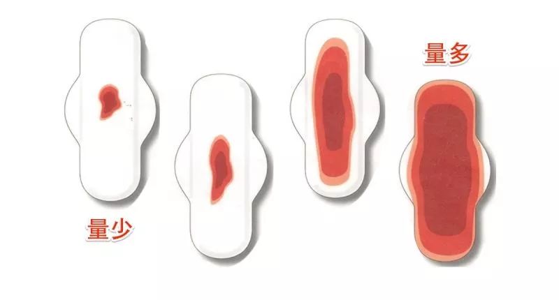 月(yuè)經、氣血、脾胃,直面肌瘤患者的(de)三大(dà)問(wèn)題!