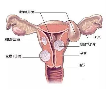 【<a href=demo2.html target=_blank class=infotextkey>加博士</a>醫(yī)囑】濕氣太重,女(nǚ)人(rén)太累,而且危害無窮